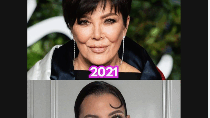 “From Elegance to Enhancement: A Striking Facial Transformation from 2021 to 2025”