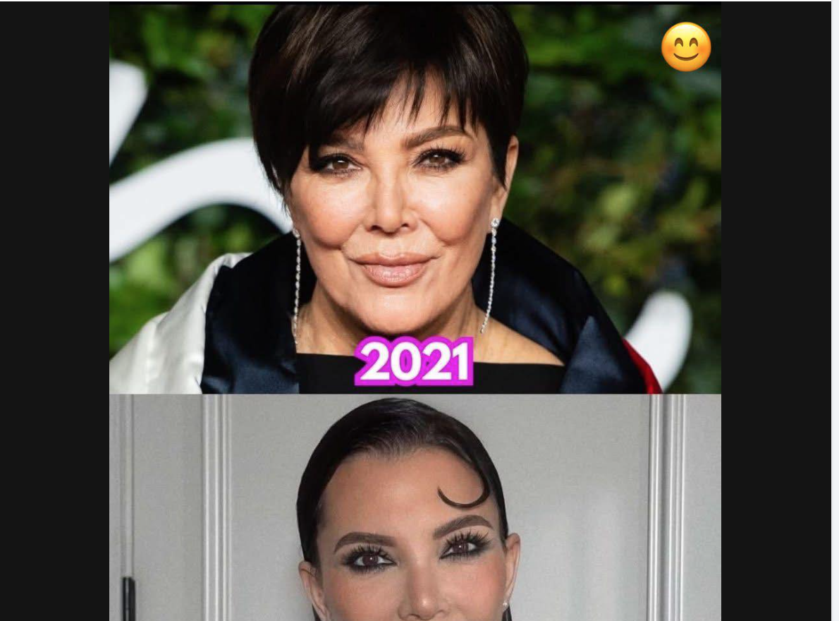 “From Elegance to Enhancement: A Striking Facial Transformation from 2021 to 2025”